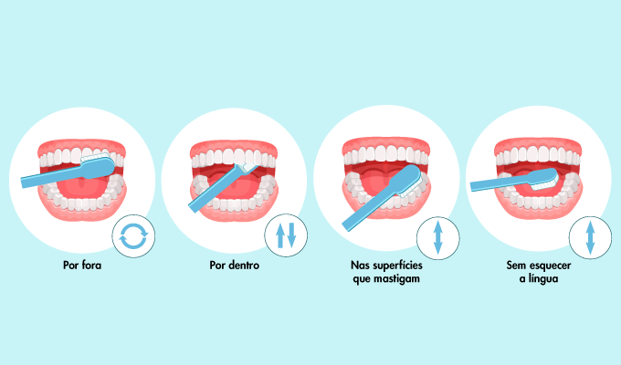 Esquema de escovagem dentária